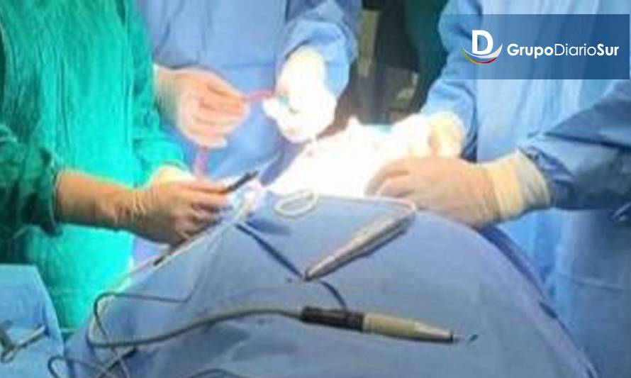 Operativo de cirugía vascular beneficia a 18 personas en diálisis de Chiloé