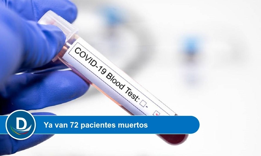 2 nuevos fallecidos por Covid-19 registró esta región 